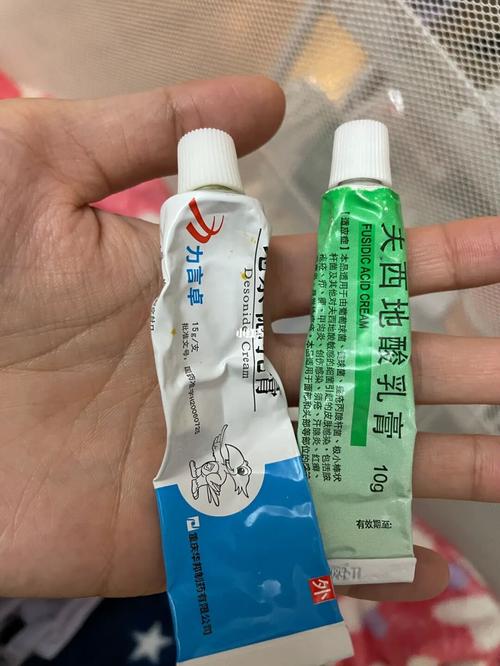 捐卵代孕的宝宝蚊虫叮咬用什么